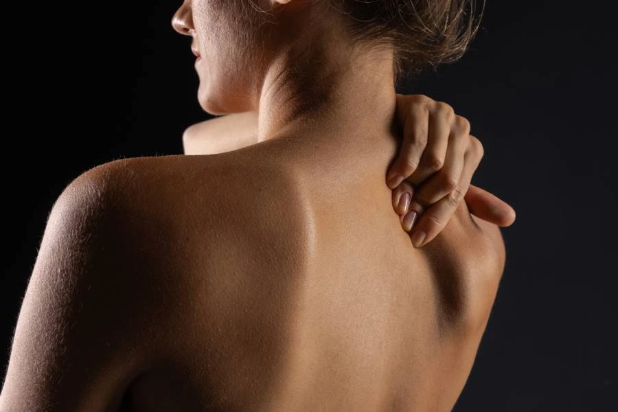 Osteoporoza – šta je, kako se prepoznaje i kako se leči?